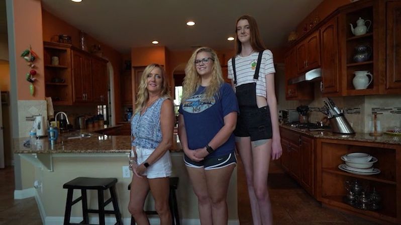 Sedmnáctiletá Američanka má nejdelší nohy na světě